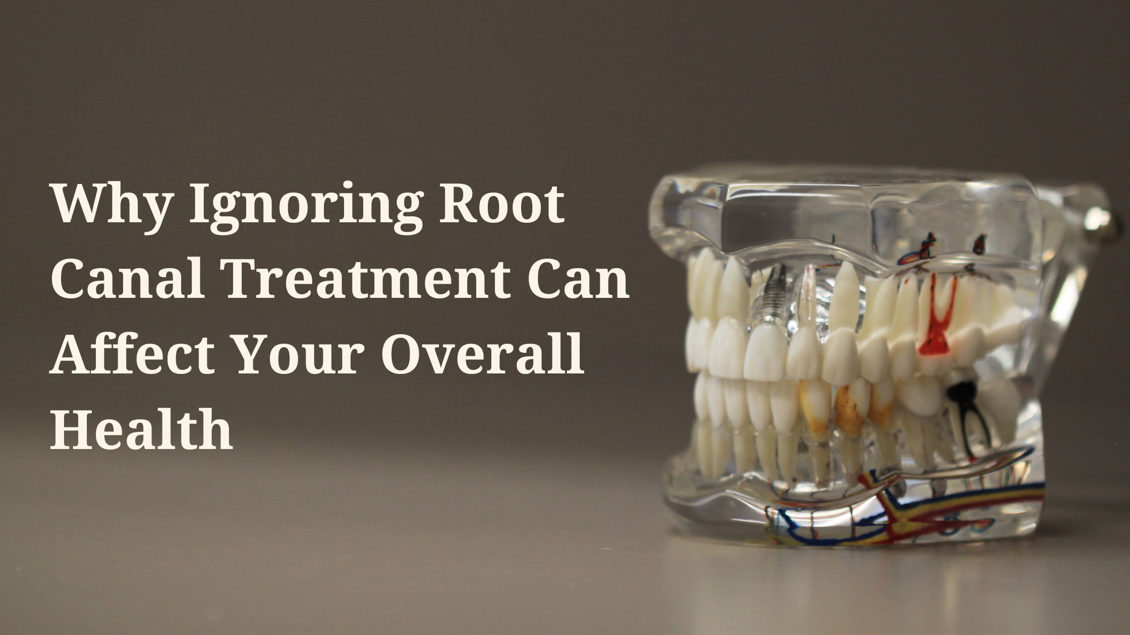 Root Canal Treatment Importance